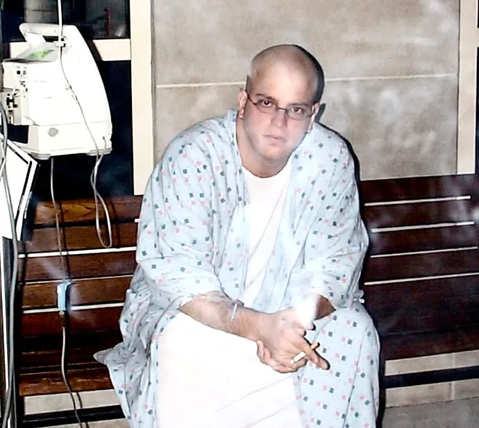 Rob Scott on a hospital bench during chemotherapy, bald, in a hospital gown